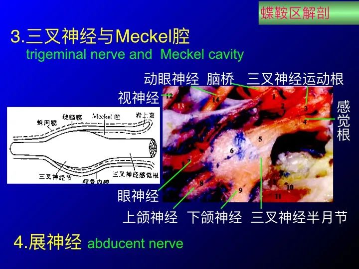 【推荐】鞍区应用解剖 断层解剖图谱