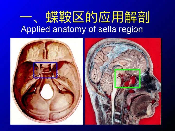 【推荐】鞍区应用解剖 断层解剖图谱