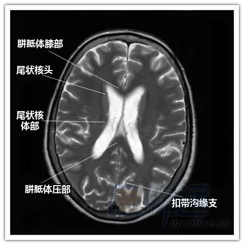  Is MRI Better Than PET Scan? A Comprehensive Comparison of Imaging Techniques for Accurate Diagnosis