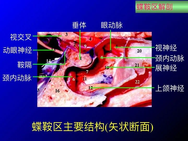 【推荐】鞍区应用解剖 断层解剖图谱