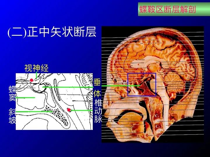 【推荐】鞍区应用解剖 断层解剖图谱