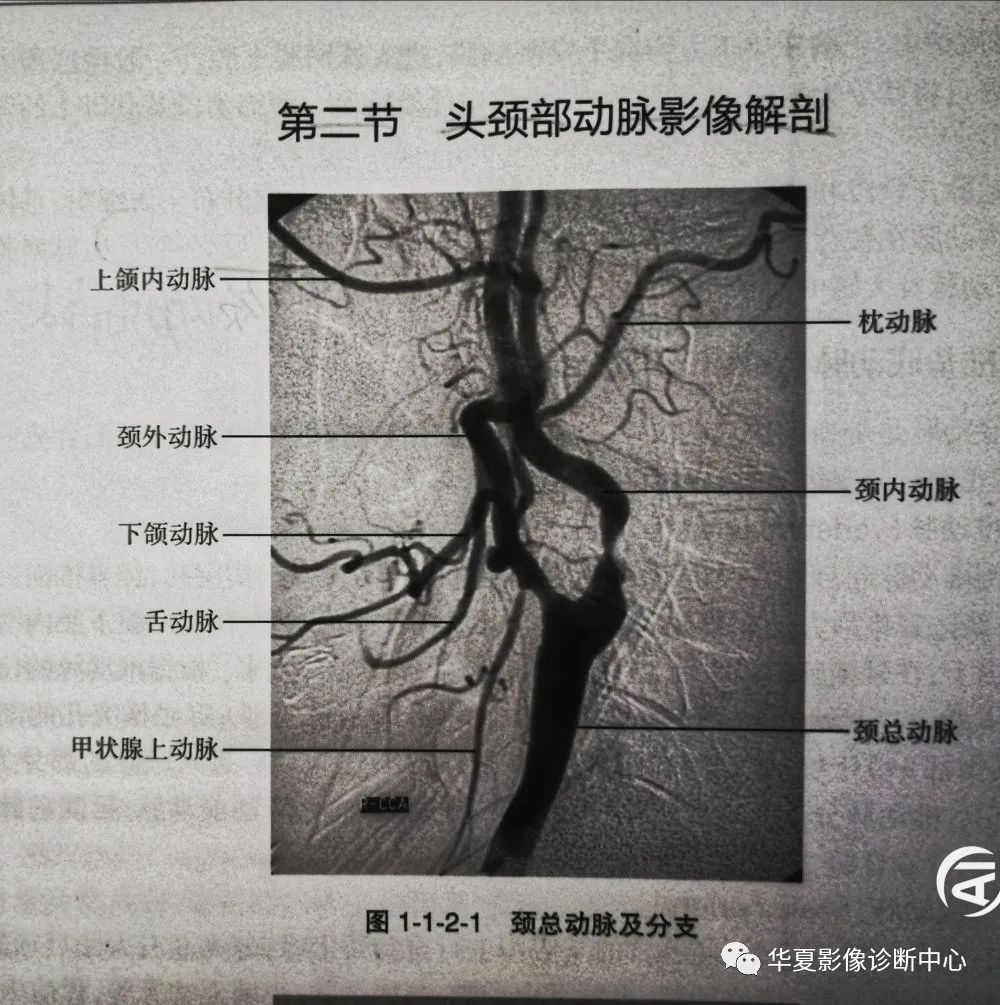 数字减影血管造影(dsa)下,头部二三级动脉血管解剖影像(下载保存)