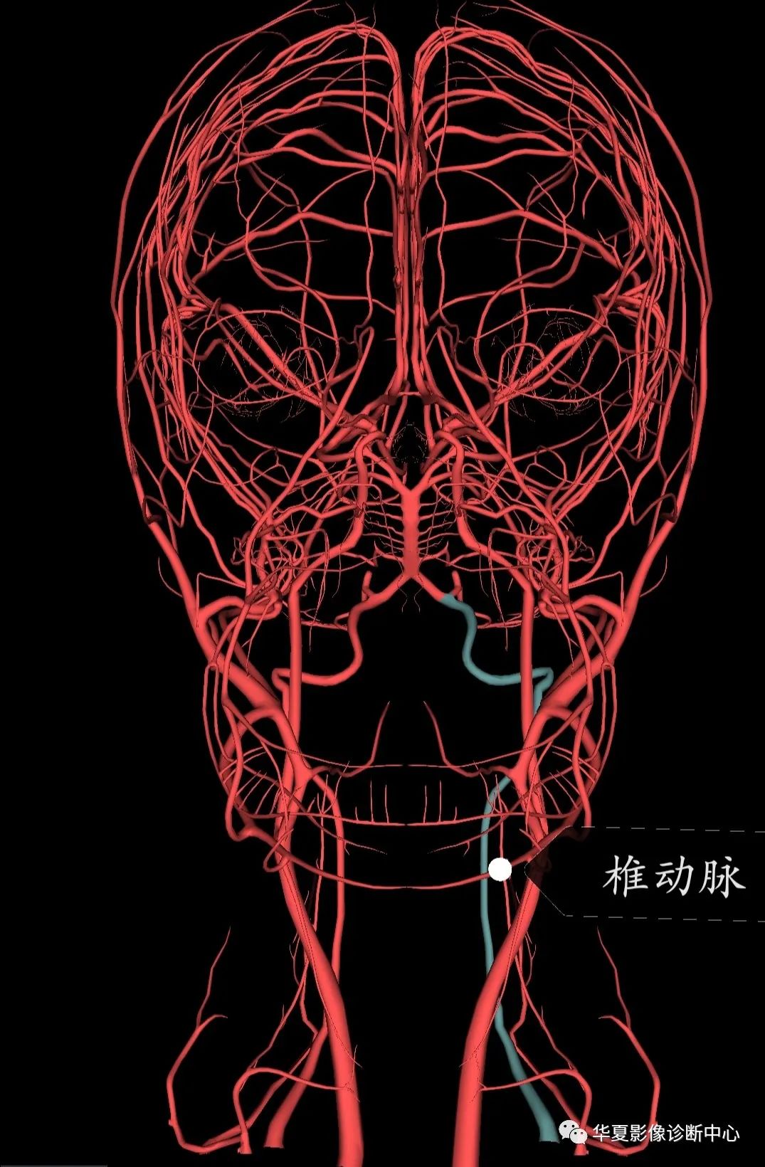 数字减影血管造影dsa下头部二三级动脉血管解剖影像下载保存