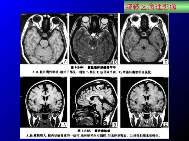 【推荐】鞍区应用解剖 断层解剖图谱