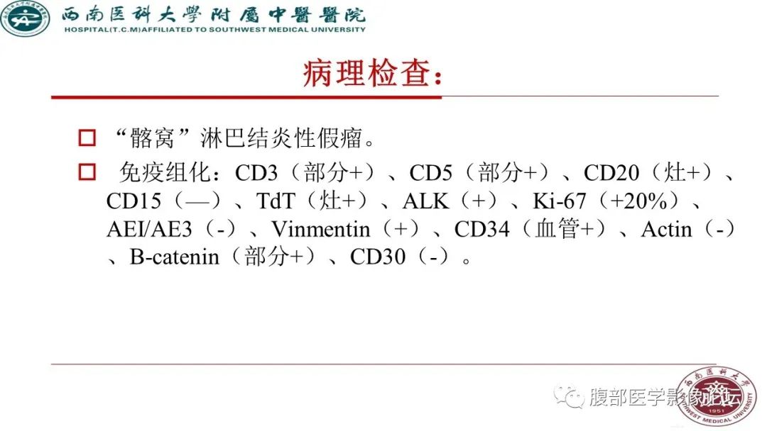 腹膜后丨髂窝淋巴结炎性假瘤