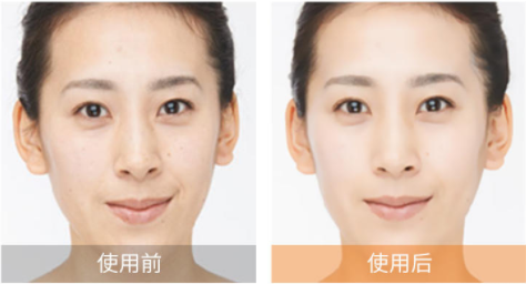 体重轻但脸胖怎么减脂 61bf2cbfcf6b45d19ee8f78e33feb6d4.png