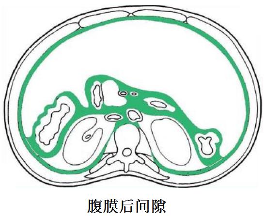 腹膜后肿瘤的腹腔热灌注如何杀死肿瘤细胞?