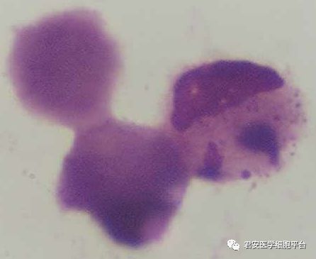 【名家讲坛】生精细胞凋亡与男性不育症