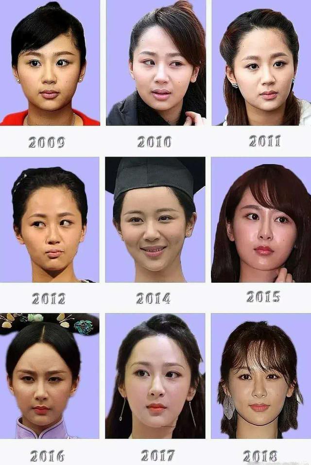 真的整容了？杨紫过去10年正脸照对比，看看她容