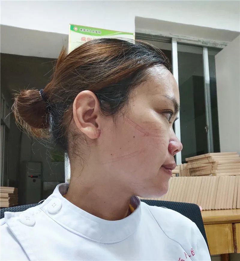 忻城县县城有多少人口(3)