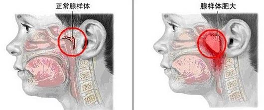 「宝宝」正在影响孩子的颜值和智力！家长别掉以轻心！这些睡眠习惯