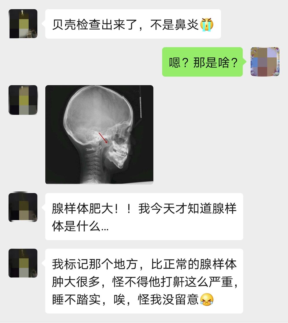 「宝宝」正在影响孩子的颜值和智力！家长别掉以轻心！这些睡眠习惯