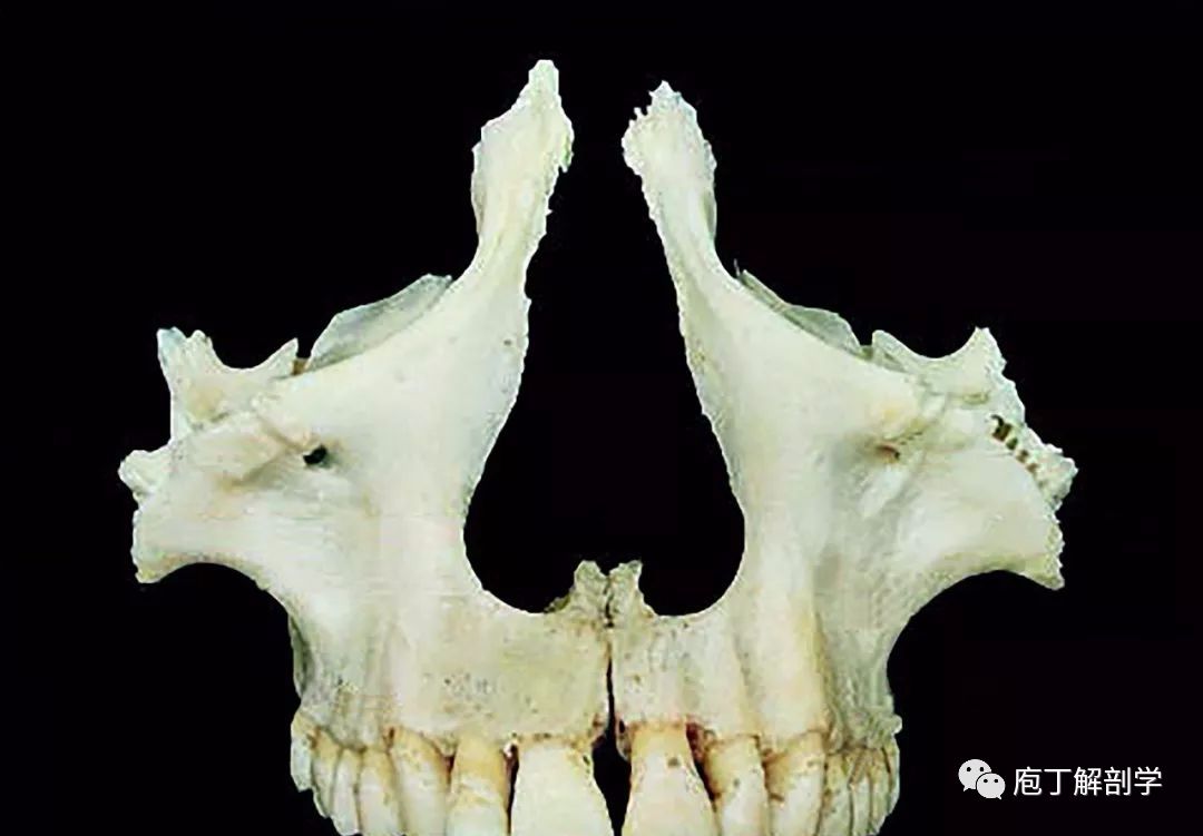 上颌骨的形态特点