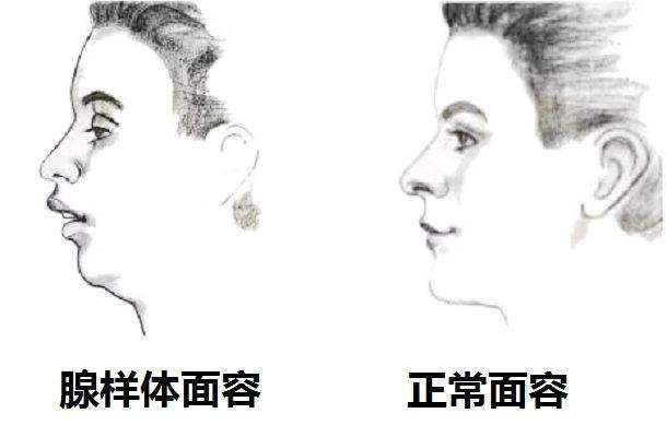 「宝宝」正在影响孩子的颜值和智力！家长别掉以轻心！这些睡眠习惯