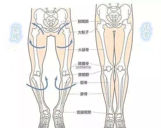 观察自己的下肢最宽的位置是否在腰际下方,腰部与大腿连接处,如果不是