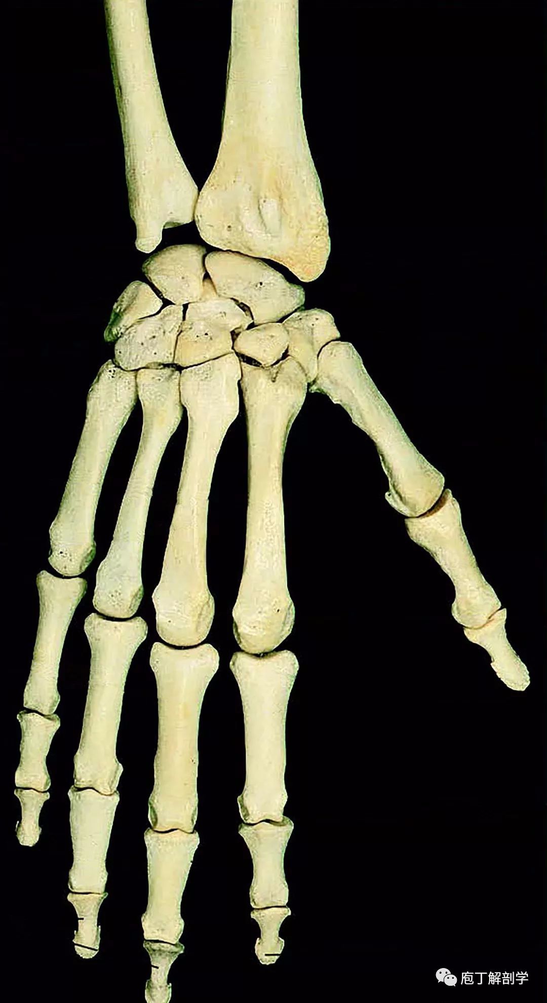图4-5 桡骨和尺骨(分离)-外科学-医学
