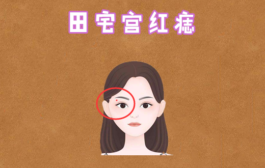 原创女人身体4颗"暗财"痣,藏得越深福越旺,天生上等命!