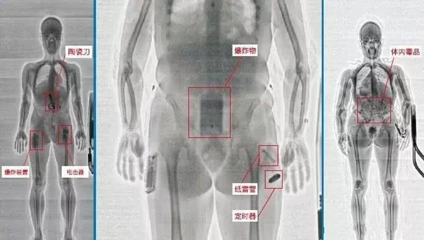 「显示器」隐私部位会暴露在显示器上吗?说出来你也许不信女性在过安检时