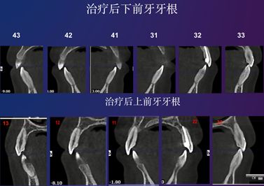 ct对比