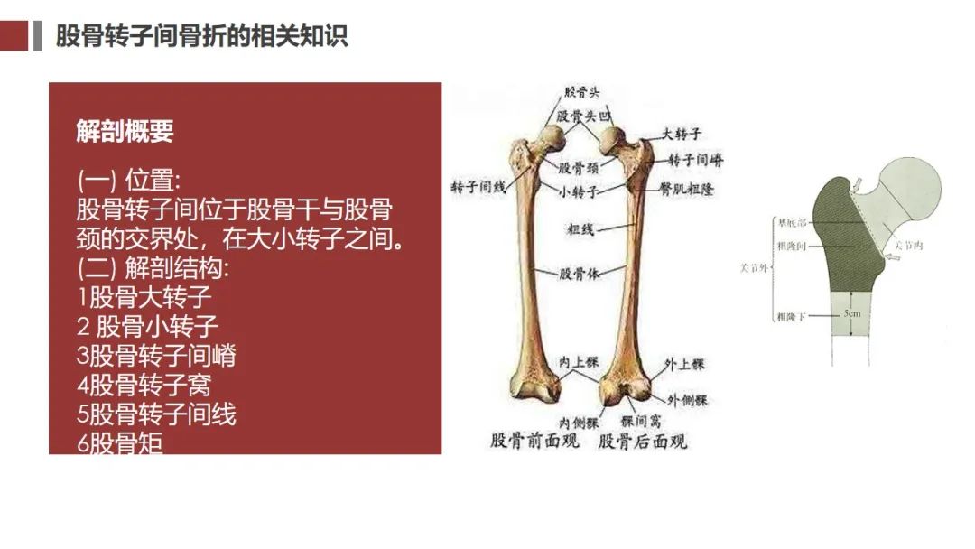 ppt股骨转子间骨折的护理查房