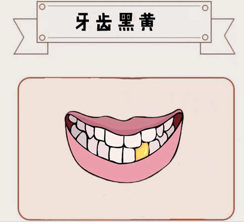 不齿相什么成语_成语故事图片(2)