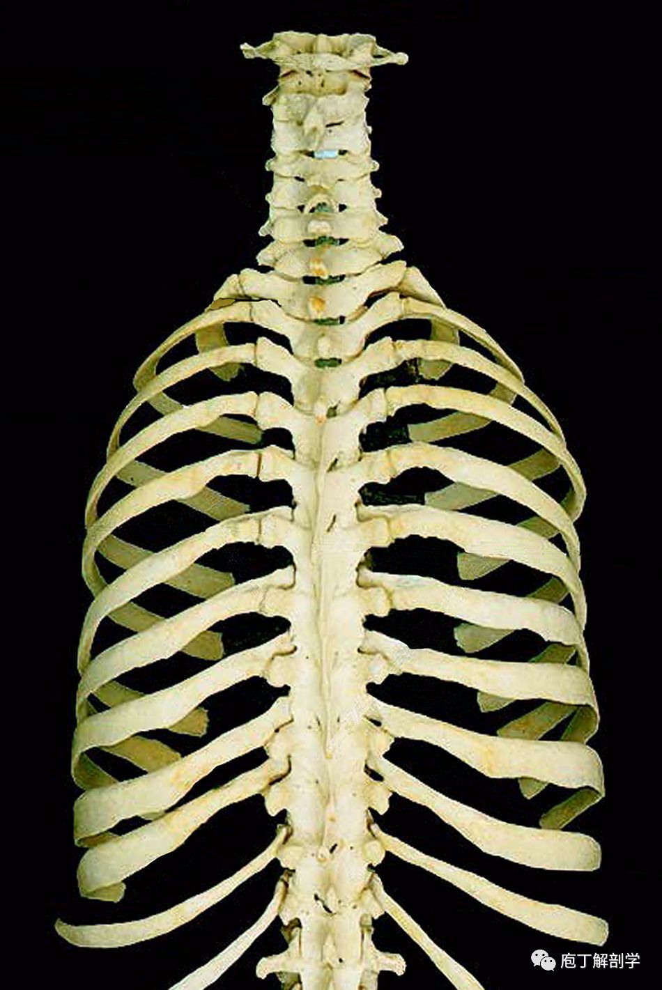 胸廓上口较小,由胸骨柄上缘,第1肋和第1胸椎椎体围成,是胸腔与颈部的