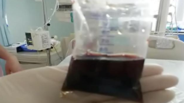 [治疗]男童高烧40.5℃！怕去医院被传染！坚持在家“自诊”！然后……