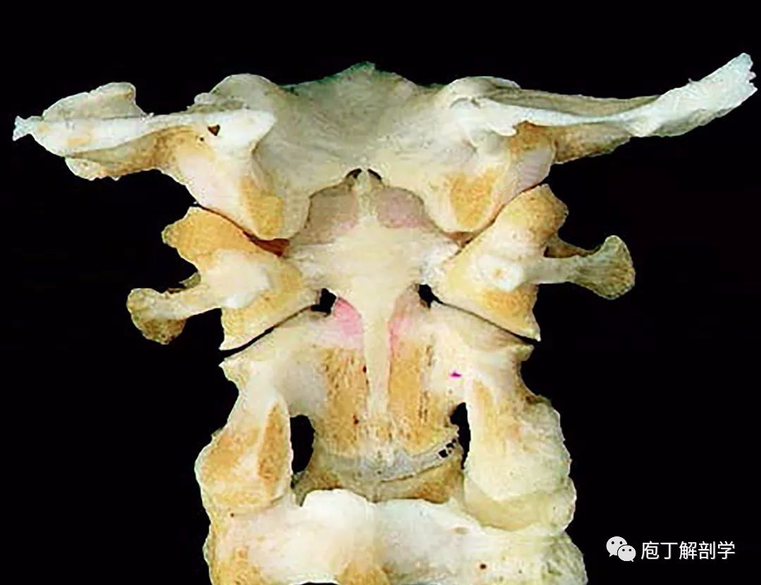 1)寰枕关节:为两侧枕髁与寰椎侧块的上关节凹构成的联合关节,屈双轴型