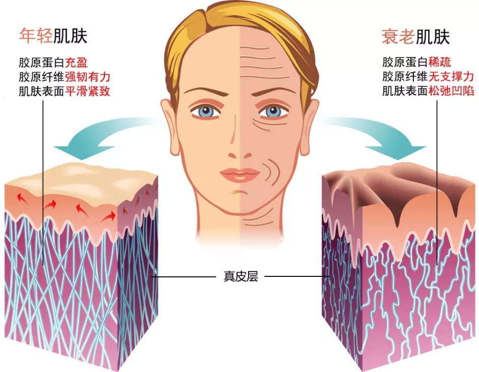 胶原蛋白与各种问题性皮肤的关系