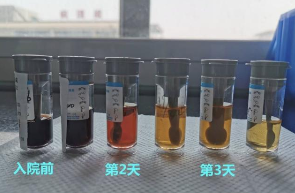 [治疗]男童高烧40.5℃！怕去医院被传染！坚持在家“自诊”！然后……