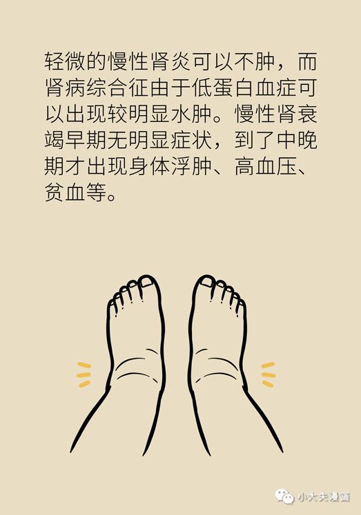 洗澡后皮肤痒是哪里出了问题 fb467d6e541947b3b8e493ad7589feda.jpeg