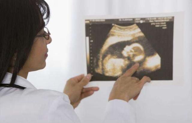 怀孕45天以后，去医院需要做哪些产检项目？这三个最重要