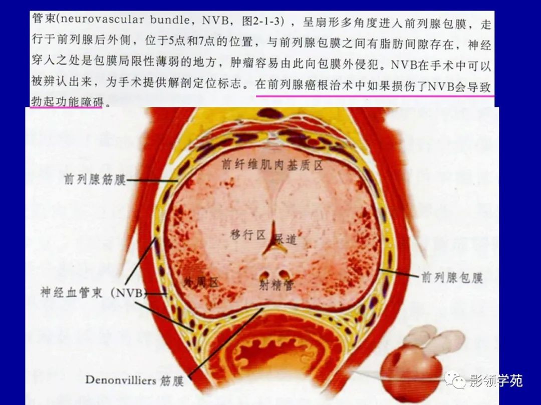 前列腺解剖及mri影像表现