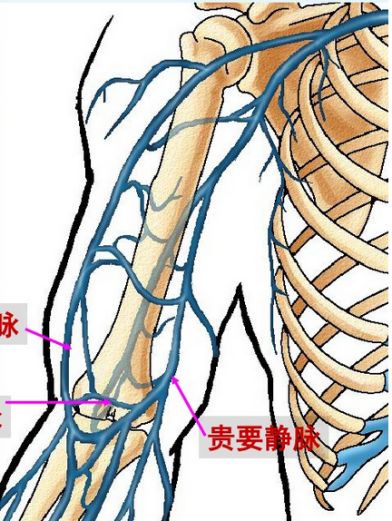 它由外周静脉(贵要静脉,肘正中静脉,头静脉)穿刺插管,其尖端位于上腔
