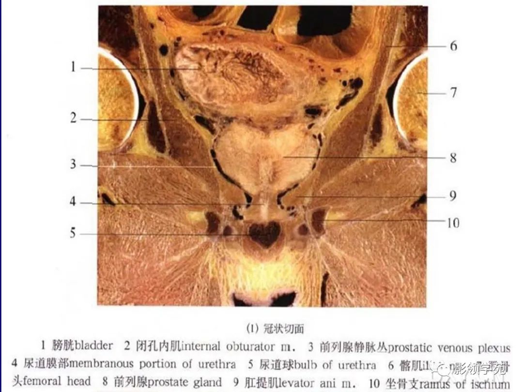 前列腺解剖及mri影像表现传播 
