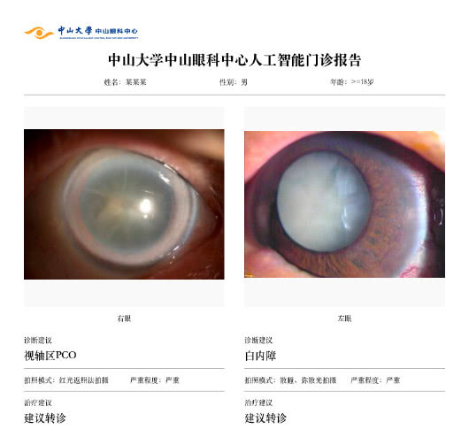 中山大学中山眼科中心联合Airdoc首创白内障人工智能多层次协同诊断