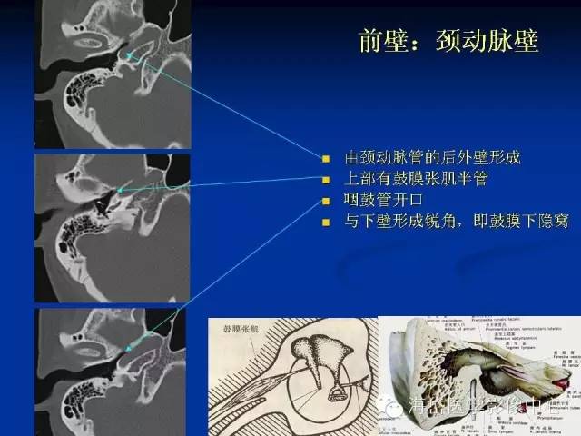 耳部ct及mri解剖