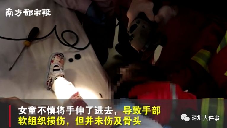 「绞手」事发时家长在家！这些需留心深圳一2岁女童手被榨汁机绞手