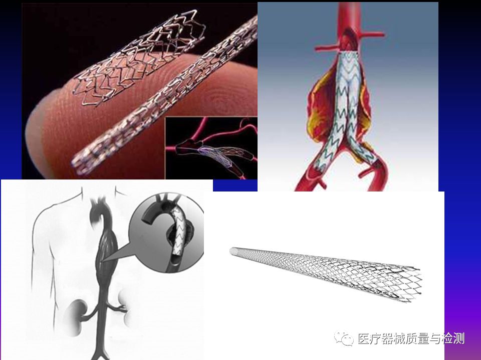 一文了解脑血管介入手术器械