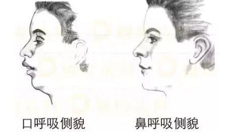 #嘴巴#张嘴呼吸的孩子会越长越丑吗口罩下的宝宝都是张着嘴巴的