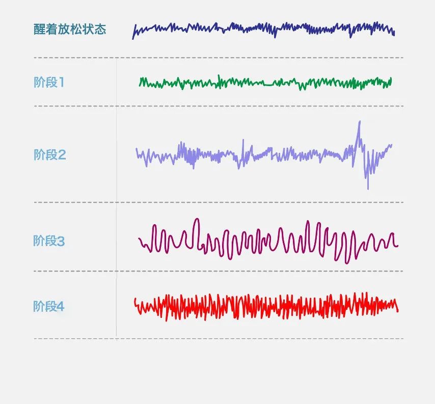 (清醒以及不同睡眠阶段的脑波图)