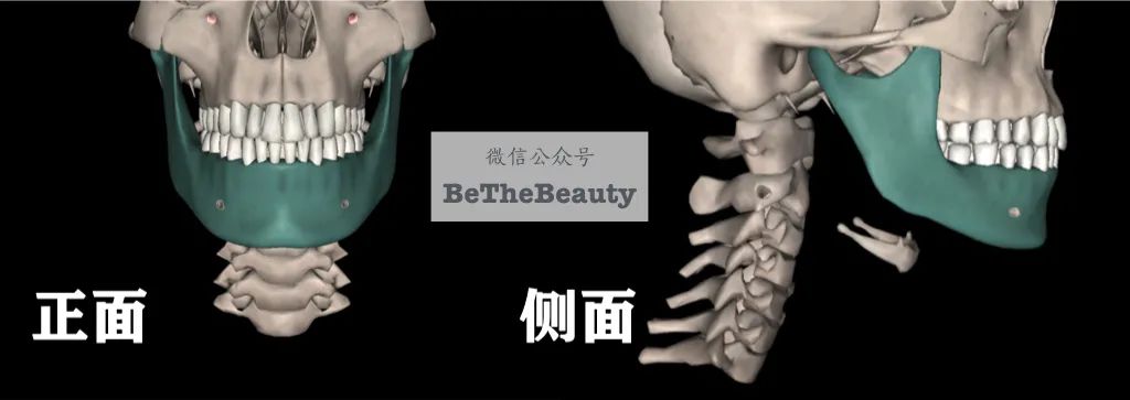 从  儿童到青春期,是下颌骨发育的高峰期