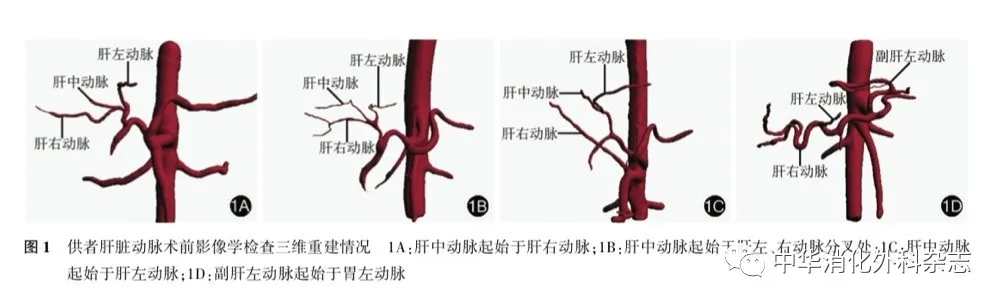 公司iqqa03三维肝脏成像系统)判断供肝肝动脉和肝静脉的解剖学特征