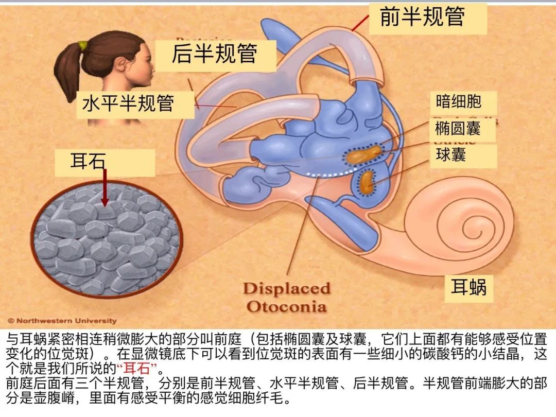 有一种眩晕叫耳石症,教你3招或可治好