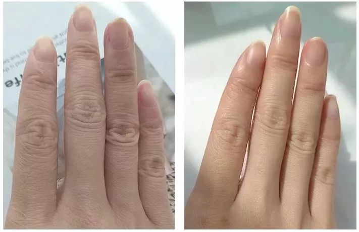 手什么时候脱皮 b8cef8efced74720b52e966375e4ce22.jpeg