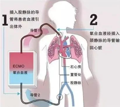 心脏搭脉怎么治疗_心脏位置(2)