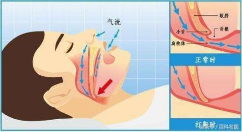 一起睡觉吗要戴耳塞的那种