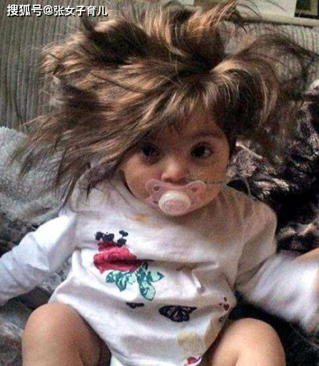 婴儿几个月长头发最快 7c34f34bb6624444a6c29491dc5423e3.png