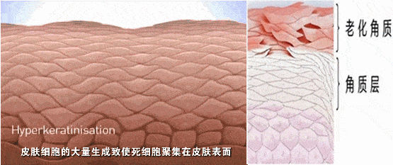 88a459ab61c74e53ace4616ca1cb5245.gif