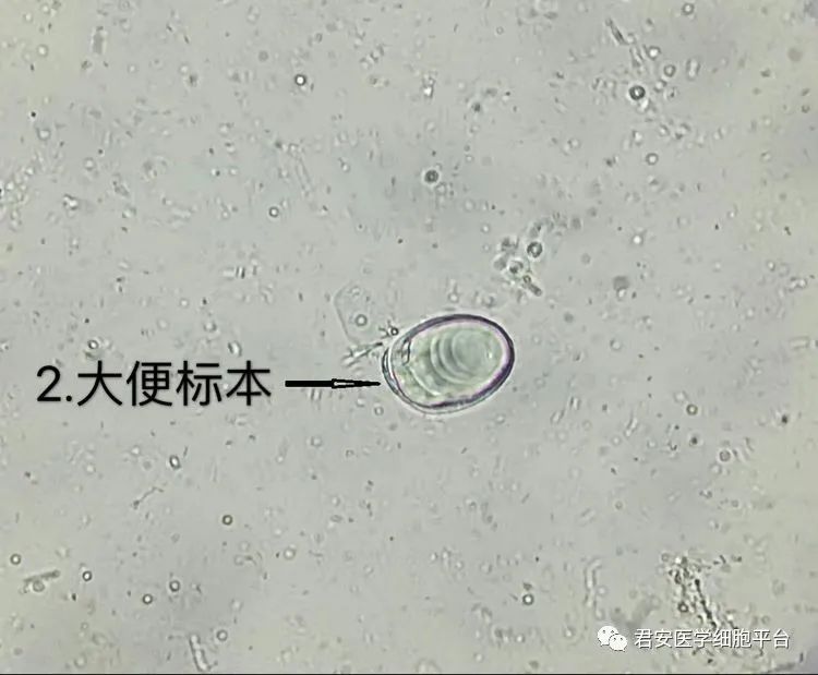 看图识细胞第75期